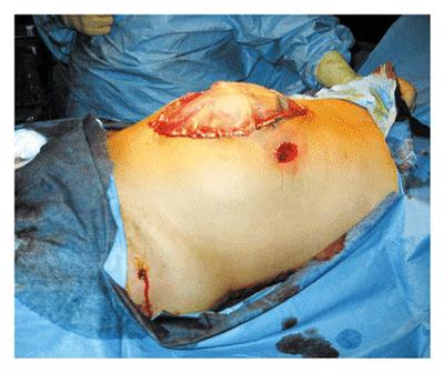 Gunshot Wound Photos